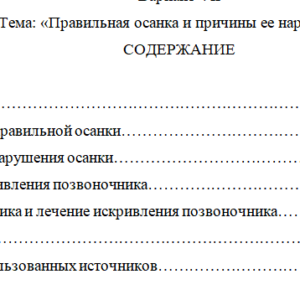 Правильная осанка и причины ее нарушения